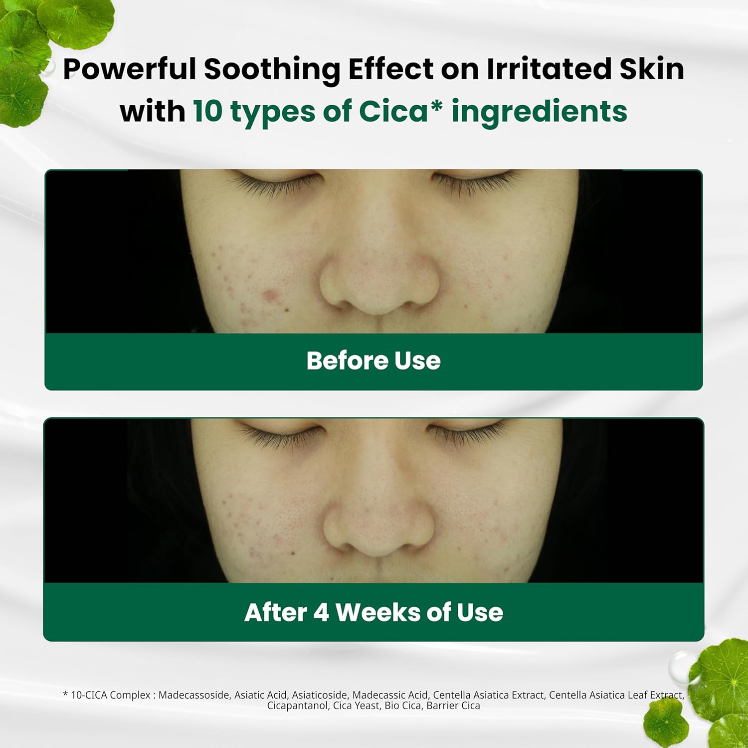 Dr.G Red Blemish Clear Soothing Cream Special Set (50mL+30mL)